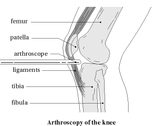 Knee Arthroscopy Anatomy